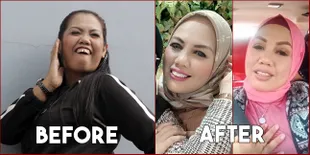 8 Foto Penampilan Elly Sugigi Sebelum dan Sesudah Potong Gigi