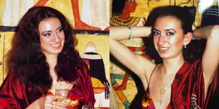 8 Potret Anastasiia Pokreschuk Model Ukraina yang Wajahnya Berubah Drastis, Perawatan Habis Rp300 Juta Hasilnya Kayak Monster