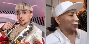 8 Potret Caren Delano yang Lakukan Oplas Hidung Karena Sulit Bernafas, Cuek Disebut Tak Syukuri Ciptaan Tuhan