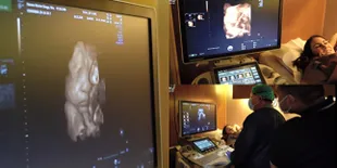 8 Potret Momo Geisha USG Kehamilan, Wajah Anak Keduanya Sudah Terlihat