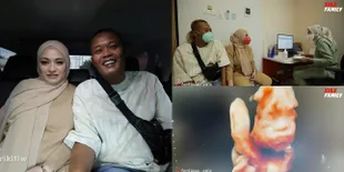 8 Potret Nathalie Holscher Periksa Kandungan Ditemani Sule, Foto USG Sang Buah Hati Disebut Mirip Banget Ayahnya!