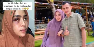8 Potret Pengusaha Fashion Tiara Luxury Boutique Jadi Korban KDRT - Babak Belur Sampai Trauma