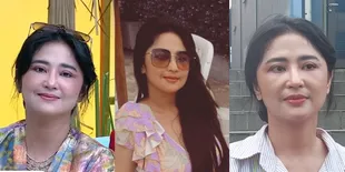 8 Potret Terbaru Dewi Perssik Dengan Wajah Bengkak yang Jadi Sorotan, Akui Telah Operasi - Untuk Persiapan Menikah?