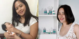 8 Potret Transformasi Farida Nurhan yang Operasi Tiga Kali, Pernah Disebut Mirip Michael Jackson