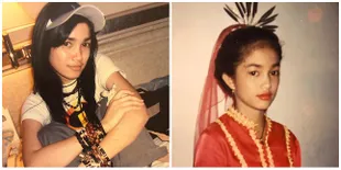 9 Foto Ussy Sulistiawaty Sebelum Jalani Operasi Tahi Lalat, Cantiknya Awet Hingga Sekarang