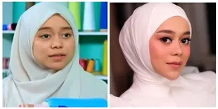 9 Potret Sebelum & Sesudah Para Penyanyi Ini Lakukan Tanam Benang, Pipi Makin Tirus - Pede Bertambah