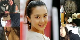 Artis Cantik China Ini Diserang Anjing Hingga Berdarah-Darah