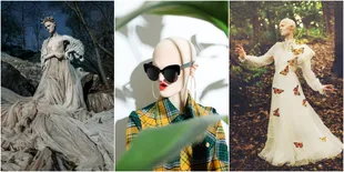 Bukan Manekin Atau Lukisan, Model Ini Alami Kelainan Langka!