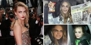 Cantik di Red Carpet, Wajah Cara Delevingne 'Hancur' di Jalanan
