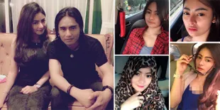 Cantiknya Vitalia Sesha, Wanita Yang Diduga Jadi Istri Charly