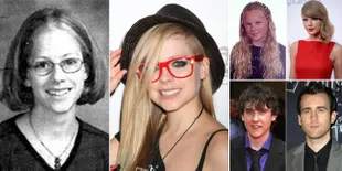 Di Balik Wajah Sempurna Para Seleb, Ternyata Mereka Pernah Culun!