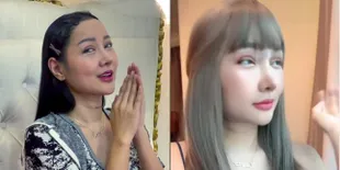 Dipuji Mirip Jisso BLACKPINK, 8 Potret Wajah Baru Lucinta Luna yang Ternyata Jahitannya Belum Kering - Suara Barunya Bikin Penasaran