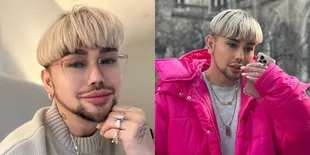 Disorot Saat Lepas Wig, 9 Fakta Oplas dan Penampilan Caren Delano yang Selama Ini Pakai Rambut Palsu - Hidung Bengkok dan Lubang Besar Sebelah