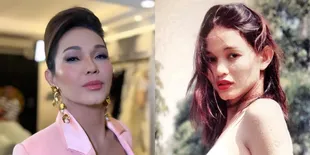 Dulu Disebut Transgender, 8 Potret Transformasi Bunda Corla yang Baru Oplas Seharga Rp1,5 Miliar - Malah Disebut Mirip Laki-Laki