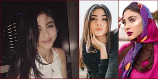 Dulu 'Kembaran' Dewi Perssik, Margin Wieheerm Kini Makin Hot