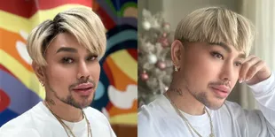 Dulu Lubang Hidungnya Beda Sebelah, Ini 8 Potret Caren Delano yang Kerap Dihujat karena Lakukan Oplas - Bibir Tebalnya Disebut Mirip ivan Gunawan