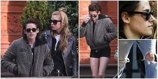 FOTO: Bareng 'Pacar Baru', Wajah-Lutut Kristen Stewart Penuh Luka