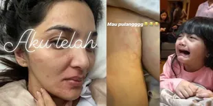 FOTO Begini Kondisi Ashanty Kala Bentol-Bentol Sakit Autoimun, Bikin Arsy Menangis
