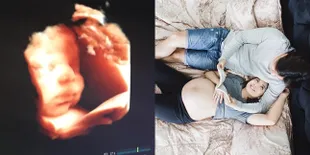 Foto Chelsea Olivia Hamil 9 Bulan, Glenn Tetap Sering Ajak Kencan