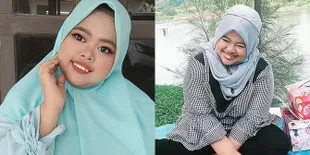 Foto-Foto Kekeyi Bangga dengan Gigi Langka-nya, Tak Malu Pamerkan dan Mengaku Tidak Akan Pernah Berubah