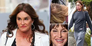 Foto-Foto Memalukan Caitlyn Jenner, Wajah Tanpa Makeup - Editan