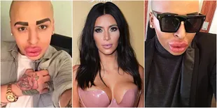 Foto-Foto Pria Yang Nekat Oplas Milyaran Demi Jadi Kim Kardashian
