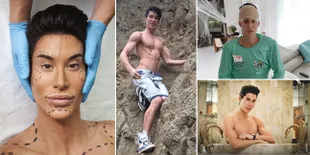 FOTO: Justin Jedlica Ketagihan Oplas & Makin Mirip Boneka Ken