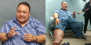 Foto Kaki Bengkak Rony Dozer yang Disebut Kena Guna-Guna Teman Syuting, Sempat Sulit Kencing - Ada Ular di Perutnya?