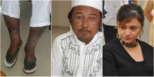 FOTO Kondisi Ayah Marshanda di Panti, Mata Sakit -Kaki Penuh Luka