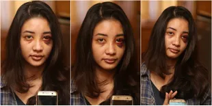 FOTO: Kronologi Pemukulan Saori Ishii, Mantan Model Asal Jepang