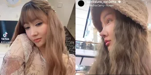 Foto Lucinta Luna Minta Pendapat Fans Wajah Oplas Barunya Mirip Siapa, Dibilang Kayak Eonnie Korea Hingga Muhammad Fatah