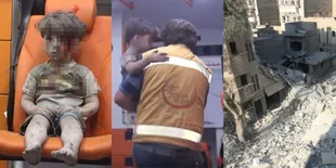FOTO: Omran, Bocah Suriah Penuh Luka Yang Bikin Dunia Nangis