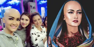 FOTO: Penampilan Jupe Dengan Kepala Gundul, Nyatanya Makin Cantik