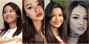 FOTO Perubahan Bentuk Alis Aurel Hermansyah, Makin Cantik Dewasa?