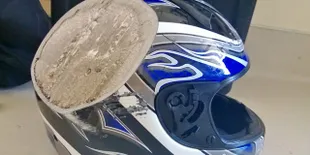 FOTO: Potret Orang-Orang Beruntung Yang Selamat Dari Maut!