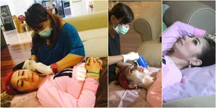 Foto Proses Femmy Permatasari Tanam Benang dan Suntik Botox