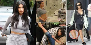 FOTO: Ruam Merah & Bersisik, Ini Penampakan Kaki Kim Kardashian