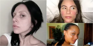 FOTO: Tak Pakai Make Up, Seleb Ini Terlihat Seperti Orang Biasa