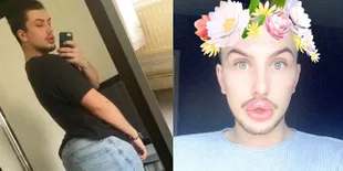 FOTO: Terobsesi Keluarga Kardashian, Pria Ini Oplas Hingga...