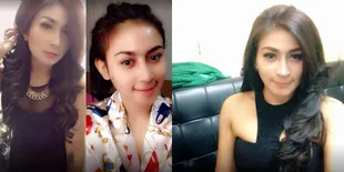 FOTO Tiara Ayu Fauziah, Model Yang Tabrak Ojol Hingga Patah Kaki