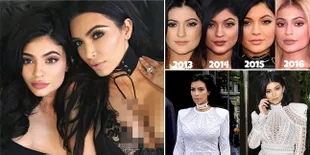 FOTO: Transformasi Kylie Jenner, Isu Oplas - Mirip Kim Kardashian