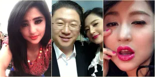 Foto Transformasi Perubahan Hidung Dewi Perssik - Tanam Benang