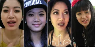 FOTO: Transformasi Wajah Widy Vierratale, Hidung Makin Mancung?