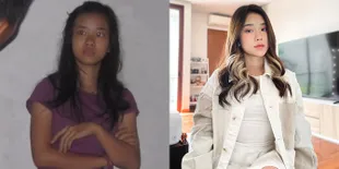 Foto Transformasi Youtuber Cantik Jessica Jane , Akui Dulu Dirinya Pernah Dekil Banget