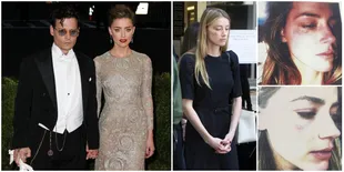 FOTO: Wajah Memar, Amber Heard Beberkan Bukti KDRT Johnny Depp