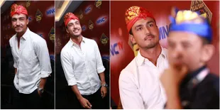 FOTO: Wajah Penuh Baut, Kisah Hamish Daud Amnesia Sampai 9 Bulan