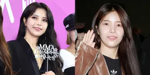 FOTO: Wajah Solar MAMAMOO Tanpa Makeup Beda Banget, Netizen Kaget