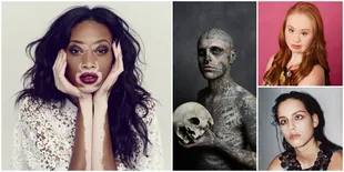 Inilah Bukti Kalau Jadi Model Tak Harus Punya Fisik Sempurna