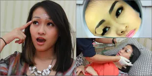 Inilah Perawatan Sulam Alis Felly Chibi Yang Habiskan Rp 12 Juta