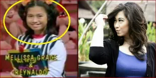 Masih Ingat Melissa 'Lenong Bocah'? Dulu Chubby Kini Memesona!